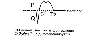 Острый период