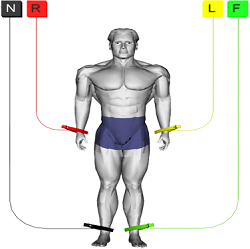 cardiovisor electrode